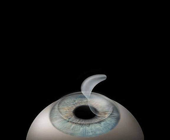 Refractive services in Muzaffarnagar - best eye hospital in Muzaffarnagar - Pal hospital eyetec clinics & the children centre